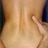Manchas de la piel | Patologias Dermatologicas